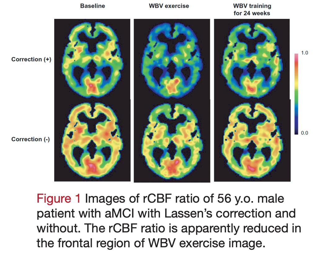 MRI Images Show How Power Plate Helps Keep Your Brain Sharp