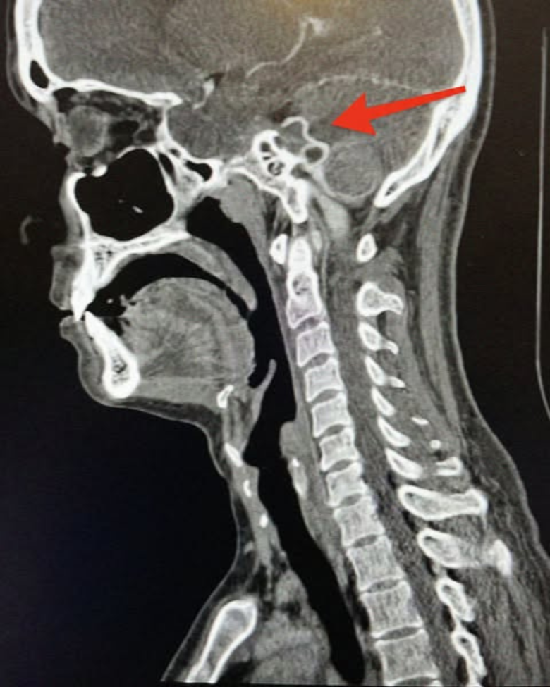 It Might Not Be Tinnitus